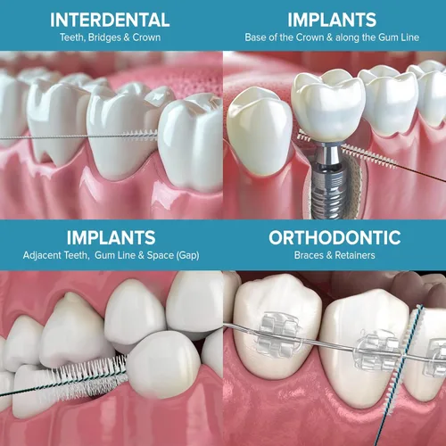 Vista 4 de Paro Isola Long Cepillo espiral interdental extra largo fácilmente doblado Herramienta de limpieza dental Rojo, 0.028-0.118 in