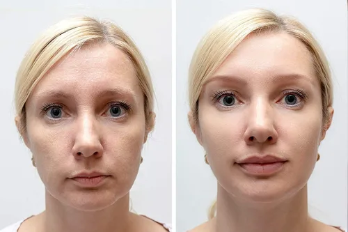 Vista 7 de Sérum de vitamina C #1 26% colágeno retinol ácido hialurónico Vitamina A, C, E, B3, B5 Aloe Vera a granel Múltiples propósitos para la piel