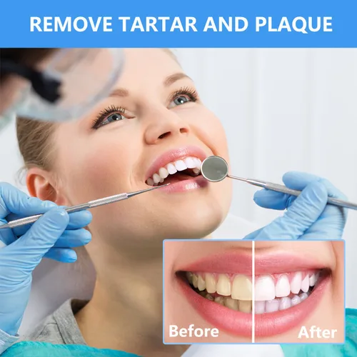 Vista 2 de Herramientas dentales, kit profesional de herramientas de limpieza de dientes, removedor de placa profesional, de acero inoxidable, raspador